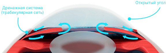 Механизм открытоугольной глаукомы. Схема нарушения работы дренажной системы глаза Структурные изменения глаза при открытоугольной глаукоме